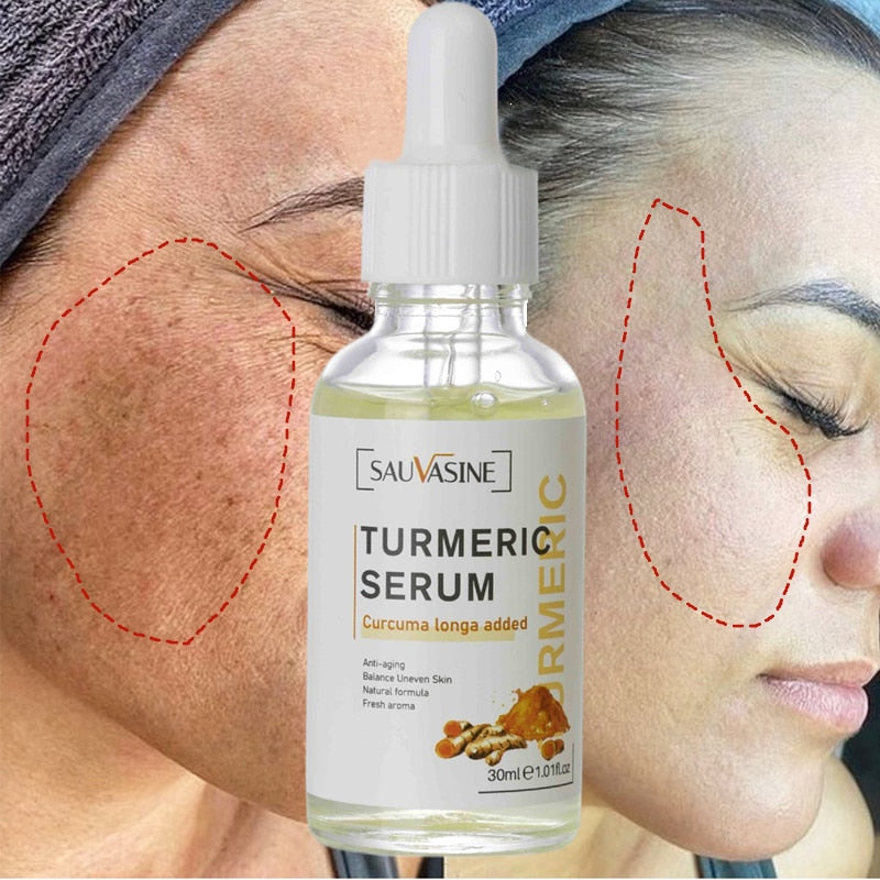 Turmeric Face Whitening Serum - Vita Luxe Skin Care 